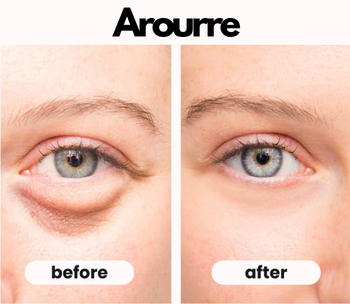 Eye Beauty Pro - Effectief tegen donkere kringen en wallen